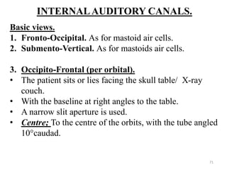 INTERNALAUDITORY CANALS.
Basic views.
1. Fronto-Occipital. As for mastoid air cells.
2. Submento-Vertical. As for mastoids air cells.
3. Occipito-Frontal (per orbital).
• The patient sits or lies facing the skull table/ X-ray
couch.
• With the baseline at right angles to the table.
• A narrow slit aperture is used.
• Centre; To the centre of the orbits, with the tube angled
10°caudad.
71
 