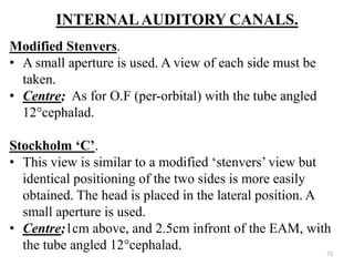 INTERNALAUDITORY CANALS.
Modified Stenvers.
• A small aperture is used. A view of each side must be
taken.
• Centre; As for O.F (per-orbital) with the tube angled
12°cephalad.
Stockholm ‘C’.
• This view is similar to a modified ‘stenvers’ view but
identical positioning of the two sides is more easily
obtained. The head is placed in the lateral position. A
small aperture is used.
• Centre;1cm above, and 2.5cm infront of the EAM, with
the tube angled 12°cephalad. 73
 