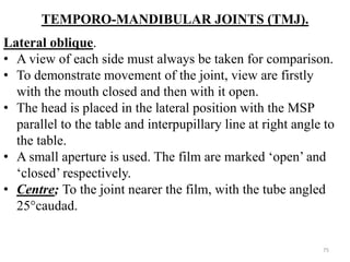 TEMPORO-MANDIBULAR JOINTS (TMJ).
Lateral oblique.
• A view of each side must always be taken for comparison.
• To demonstrate movement of the joint, view are firstly
with the mouth closed and then with it open.
• The head is placed in the lateral position with the MSP
parallel to the table and interpupillary line at right angle to
the table.
• A small aperture is used. The film are marked ‘open’ and
‘closed’ respectively.
• Centre; To the joint nearer the film, with the tube angled
25°caudad.
75
 