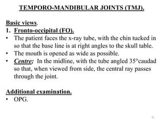 TEMPORO-MANDIBULAR JOINTS (TMJ).
Basic views.
1. Fronto-occipital (FO).
• The patient faces the x-ray tube, with the chin tucked in
so that the base line is at right angles to the skull table.
• The mouth is opened as wide as possible.
• Centre; In the midline, with the tube angled 35°caudad
so that, when viewed from side, the central ray passes
through the joint.
Additional examination.
• OPG.
76
 