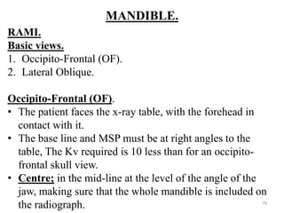MANDIBLE.
RAMI.
Basic views.
1. Occipito-Frontal (OF).
2. Lateral Oblique.
Occipito-Frontal (OF).
• The patient faces the x-ray table, with the forehead in
contact with it.
• The base line and MSP must be at right angles to the
table, The Kv required is 10 less than for an occipito-
frontal skull view.
• Centre; in the mid-line at the level of the angle of the
jaw, making sure that the whole mandible is included on
the radiograph. 79
 