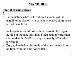 MANDIBLE.
Special circumstances.
2.
• It is sometimes difficult to show the ramus of the
mandible satisfactorily in patient who have short necks
or thick shoulders.
• Such a patient should sit with the cassette held against
the side of the face and should then bend towards that
side, so that the MSP is at approximately 35° to the
horizontal.
• Centre; 5cm below the angle of the jaw remote from
the film, with the tube horizontal.
81
 
