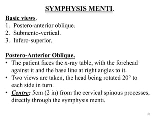SYMPHYSIS MENTI.
Basic views.
1. Postero-anterior oblique.
2. Submento-vertical.
3. Infero-superior.
Postero-Anterior Oblique.
• The patient faces the x-ray table, with the forehead
against it and the base line at right angles to it.
• Two views are taken, the head being rotated 20° to
each side in turn.
• Centre; 5cm (2 in) from the cervical spinous processes,
directly through the symphysis menti.
82
 