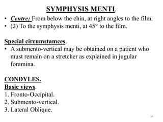 SYMPHYSIS MENTI.
• Centre; From below the chin, at right angles to the film.
• (2) To the symphysis menti, at 45° to the film.
Special circumstamces.
• A submento-vertical may be obtained on a patient who
must remain on a stretcher as explained in jugular
foramina.
CONDYLES.
Basic views.
1. Fronto-Occipital.
2. Submento-vertical.
3. Lateral Oblique.
84
 