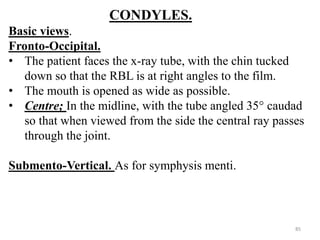 CONDYLES.
Basic views.
Fronto-Occipital.
• The patient faces the x-ray tube, with the chin tucked
down so that the RBL is at right angles to the film.
• The mouth is opened as wide as possible.
• Centre; In the midline, with the tube angled 35° caudad
so that when viewed from the side the central ray passes
through the joint.
Submento-Vertical. As for symphysis menti.
85
 