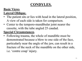 CONDYLES.
Basic Views.
Lateral Oblique.
• The patient sits or lies with head in the lateral position,
A view of each side is taken for comparison.
• Center to the temporo-mandibular joint nearer the
cassette, with the tube angled 25 caudad.
Special Circumstances.
• Following trauma, the whole of mandible must be
demonstrated because a blow to one side of the face,
particularly near the angle of the jaw, can result in a
fracture of the neck of the mandible on the other side,
i.e. ‘contre coup’ injury.
86
 