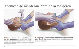Técnicas de mantenimiento de la vía aérea
 