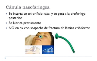 Cánula nasofaríngea
 Se inserta en un orificio nasal y se pasa a la orofarínge
posterior
 Se lubrica previamente
 NO en px con sospecha de fractura de lámina cribiforme
 