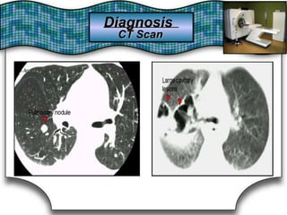 DiagnosisDiagnosis
CT ScanCT Scan
 
