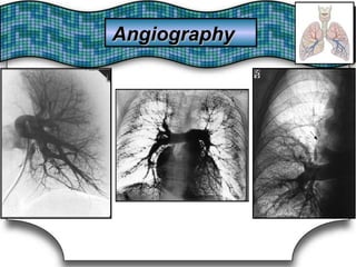 AngiographyAngiography
 