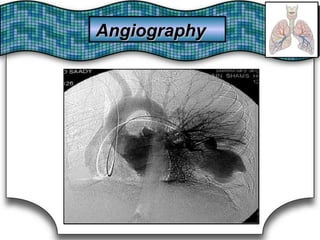 AngiographyAngiography
 