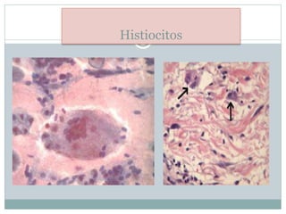 Histiocitos
 