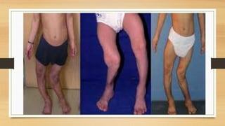 FAT SOLUBALE VITAMIN