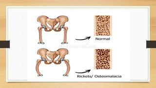 FAT SOLUBALE VITAMIN