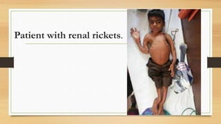 FAT SOLUBALE VITAMIN