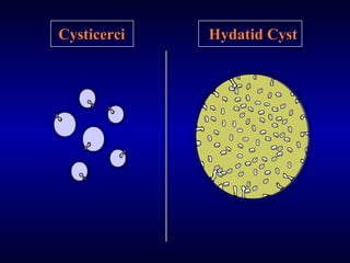 helminthic infection | PPT