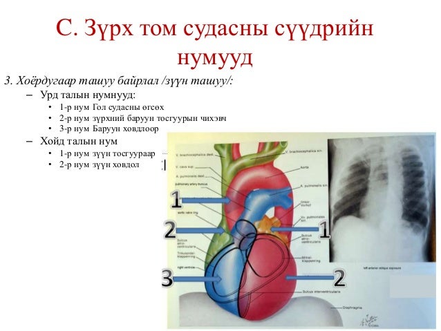 зүрх том судасны дүрс оношлогоо