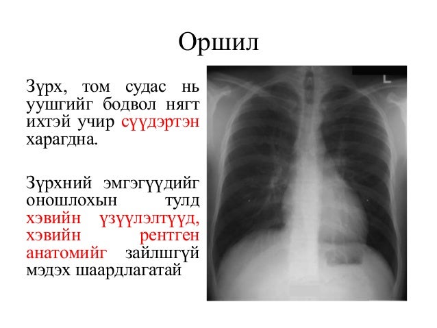 зүрх том судасны дүрс оношлогоо