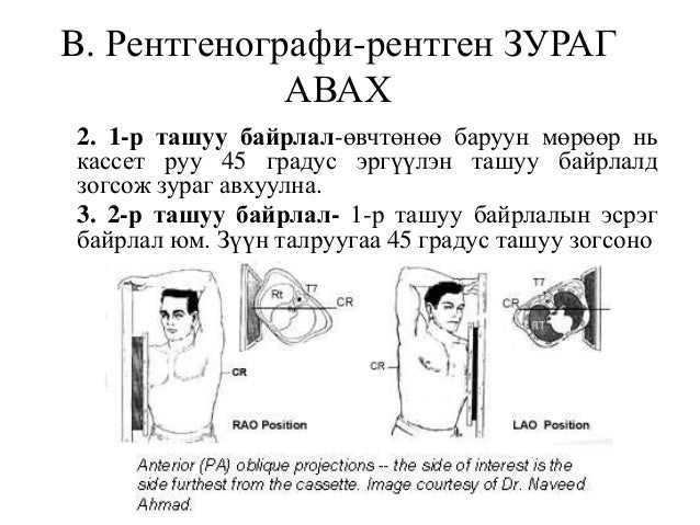 зүрх том судасны дүрс оношлогоо