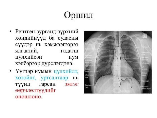 зүрх том судасны дүрс оношлогоо