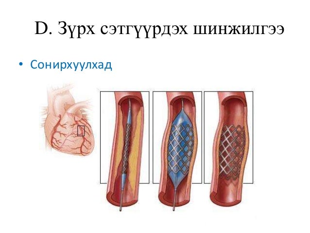 зүрх том судасны дүрс оношлогоо