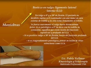 Esguince de Rodilla
