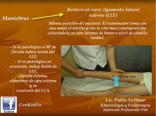 Esguince de Rodilla