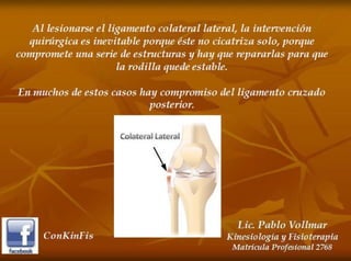 Esguince de Rodilla