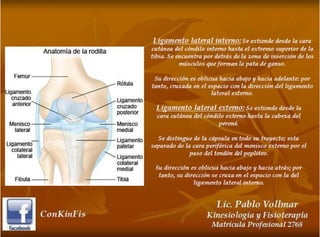 Esguince de Rodilla