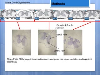 Methods
• 10μm-thick, 100μm apart tissue sections were compared to a spinal cord atlas and organized
accordingly
Spinal Cord Organization
L1 L2 L3 L4 L5 L6
Ventral Horn
Cuneate & Gracile
fasiculus
Dorsal Horn
 