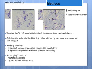 Methods
Neuronal Morphology
• Targeted the VH of cresyl violet stained tissues sections captured at 40x
• Cell diameter estimated by bisecting cell of interest by two lines; size measured
with ImageJ
• “Healthy” neurons:
- prominent nucleolus; definitive neuron-like morphology
- 1-5 processes present within the plane of sectioning
• “Atrophying” neurons:
- neuronal shrinkage
- hyperchromatic appearance
ǂ
ǂ
ǂ
ǂ
†
†
ǂ Atrophying MN
† Apparently Healthy MN
 