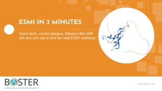 www.bosterbio.com
ESM1 IN 3 MINUTES
Quick facts, control designs, Western Blot MW.
Info you can use to find the best ESM1 antibody.
 