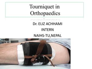 Tourniquet in
Orthopaedics
Dr. ELIZ ACHHAMI
INTERN
NAIHS-TU,NEPAL
 