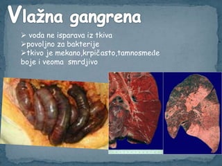  voda ne isparava iz tkiva
povoljno za bakterije
tkivo je mekano,krpičasto,tamnosmeđe
boje i veoma smrdjivo
 