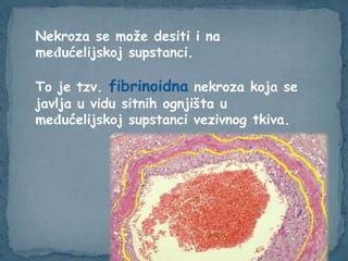 Nekroza se može desiti i na
međućelijskoj supstanci.
To je tzv. fibrinoidna nekroza koja se
javlja u vidu sitnih ognjišta u
međućelijskoj supstanci vezivnog tkiva.
 