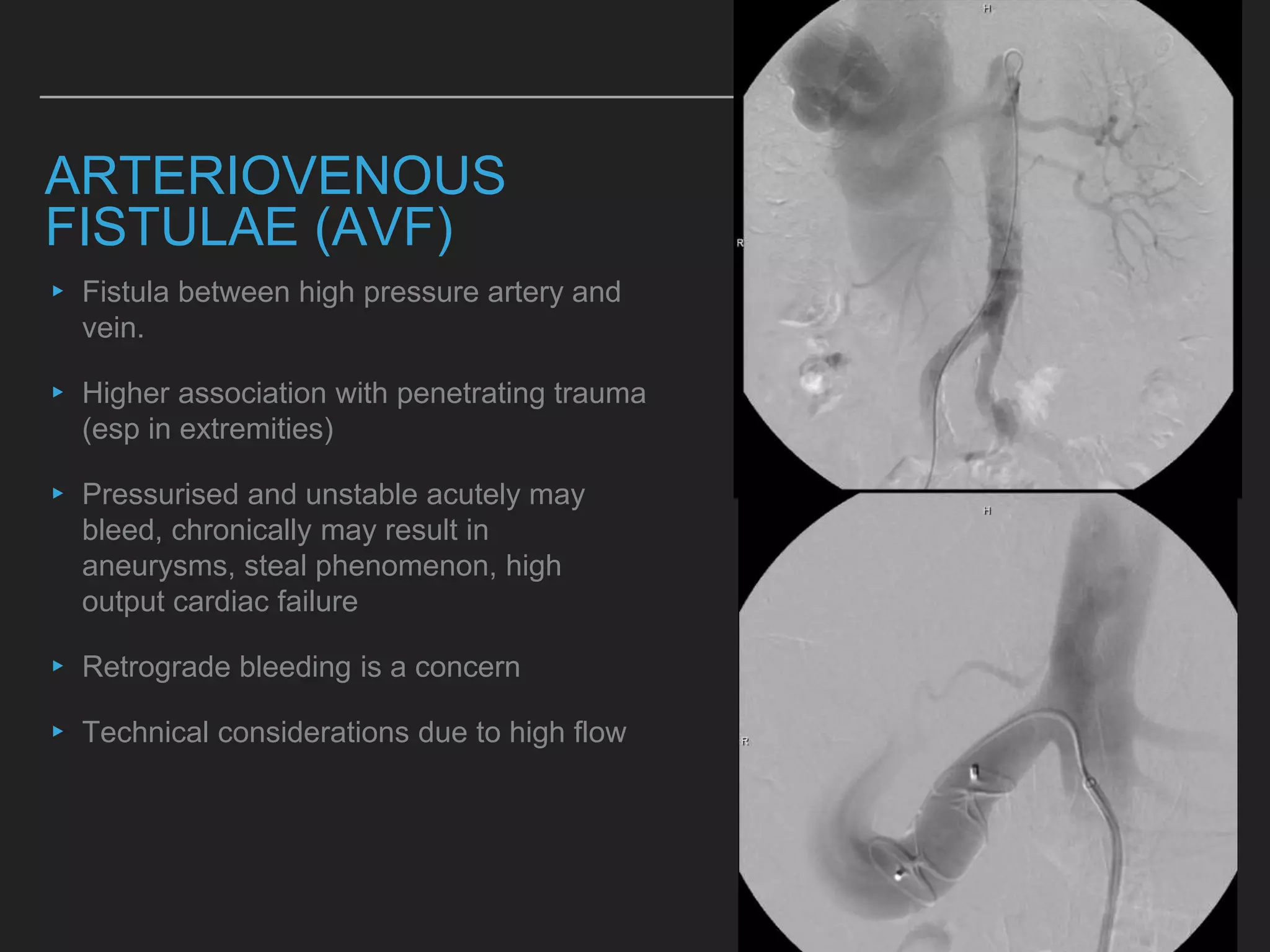 Interventional radiology: standing member or invite only? | PPTX