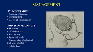MANAGEMENT
POINTS TO NOTE
• Presence of fracture
• Displacement
• Degree of comminution
POINTS OF ALIGNMENT
• ZF suture
• Infraorbital rim
• ZM buttress
• Zygomatic arch
• Greater wing of sphenoid
(Lat .wall of orbit)
• Orbital floor
 