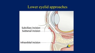 Lower eyelid approaches
 