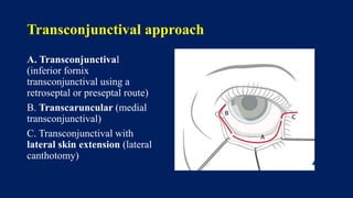 Transconjunctival approach
A. Transconjunctival
(inferior fornix
transconjunctival using a
retroseptal or preseptal route)
B. Transcaruncular (medial
transconjunctival)
C. Transconjunctival with
lateral skin extension (lateral
canthotomy)
 