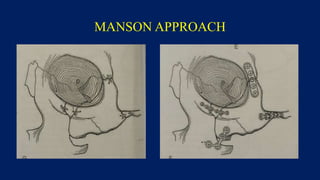 MANSON APPROACH
 