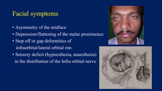 Facial symptoms
• Asymmetry of the midface
• Depression/flattening of the malar prominence
• Step off or gap deformities of
infraorbital/lateral orbital rim
• Sensory deficit (hypoesthesia, anaesthesia)
in the distribution of the Infra orbital nerve
 