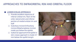 Subciliary Approach Incision Zygoma fractures - A guide to facial reconstruction.pptx