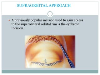 Zygomatic Complex Fracture- ZMC | PPTX