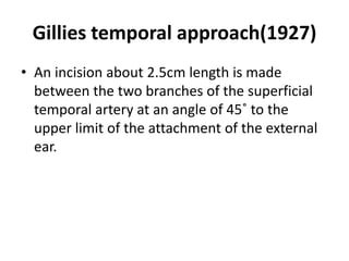 Gillies temporal approach(1927)
• An incision about 2.5cm length is made
between the two branches of the superficial
temporal artery at an angle of 45˚ to the
upper limit of the attachment of the external
ear.
 