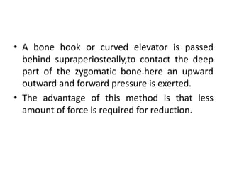 • A bone hook or curved elevator is passed
behind supraperiosteally,to contact the deep
part of the zygomatic bone.here an upward
outward and forward pressure is exerted.
• The advantage of this method is that less
amount of force is required for reduction.
 