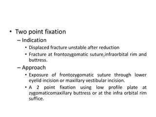 • Two point fixation
– Indication
• Displaced fracture unstable after reduction
• Fracture at frontozygomatic suture,infraorbital rim and
buttress.
– Approach
• Exposure of frontozygomatic suture through lower
eyelid incision or maxillary vestibular incision.
• A 2 point fixation using low profile plate at
zygomaticomaxillary buttress or at the infra orbital rim
suffice.
 
