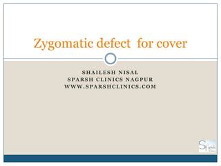 Zygomatic defect for cover

         SHAILESH NISAL
      SPARSH CLINICS NAGPUR
     WWW.SPARSHCLINICS.COM
 