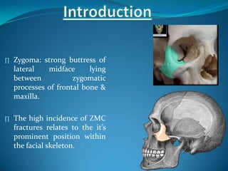 ∏ Zygoma: strong buttress of
lateral midface lying
between zygomatic
processes of frontal bone &
maxilla.
∏ The high incidence of ZMC
fractures relates to the it’s
prominent position within
the facial skeleton.
 