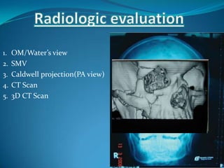 1. OM/Water’s view
2. SMV
3. Caldwell projection(PA view)
4. CT Scan
5. 3D CT Scan
 