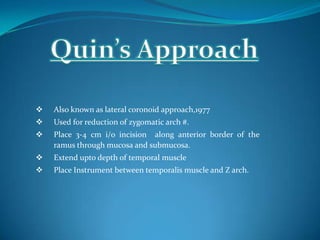  Also known as lateral coronoid approach,1977
 Used for reduction of zygomatic arch #.
 Place 3-4 cm i/o incision along anterior border of the
ramus through mucosa and submucosa.
 Extend upto depth of temporal muscle
 Place Instrument between temporalis muscle and Z arch.
 